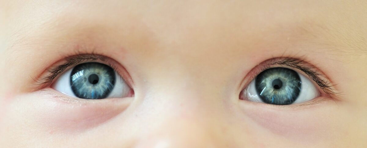 Sondowanie kanału łzowego u niemowlaka